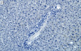 Anti-α Actinin Antibody, clone AT6/172 ZooMAb® Mouse Monoclonal recombinant, expressed in HEK 293 cells