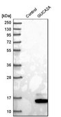 Anti-GUCA2A antibody produced in rabbit Prestige Antibodies® Powered by Atlas Antibodies, affinity isolated antibody, buffered aqueous glycerol solution