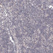 Anti-TACC2 antibody produced in rabbit Prestige Antibodies® Powered by Atlas Antibodies, affinity isolated antibody, buffered aqueous glycerol solution