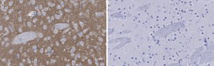 Anti-mGluR5 Antibody, clone 1F11 ZooMAb® Rabbit Monoclonal recombinant, expressed in HEK 293 cells