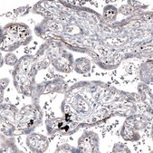 Monoclonal Anti-LAMA2 antibody produced in mouse Prestige Antibodies® Powered by Atlas Antibodies, clone CL3450, purified immunoglobulin, buffered aqueous glycerol solution