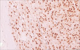 SF-1 (EP434) Rabbit Monoclonal Primary Antibody