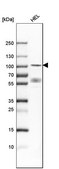 Anti-DYRK1A antibody produced in rabbit Prestige Antibodies® Powered by Atlas Antibodies, affinity isolated antibody, buffered aqueous glycerol solution