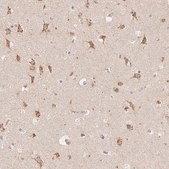 Anti-STK39 antibody produced in rabbit Prestige Antibodies® Powered by Atlas Antibodies, affinity isolated antibody, buffered aqueous glycerol solution