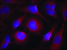Anti-PTK2B (Ab-402) antibody produced in rabbit affinity isolated antibody