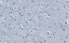 Anti-Opioid Receptor μ Antibody, clone 1E5 ZooMAb® Rabbit Monoclonal recombinant, expressed in HEK 293 cells