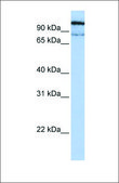 Anti-GAA antibody produced in rabbit affinity isolated antibody