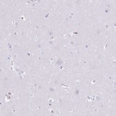 Anti-HRG antibody produced in rabbit Prestige Antibodies® Powered by Atlas Antibodies, affinity isolated antibody, buffered aqueous glycerol solution