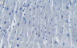 Anti-MLC-2/MYL2 Antibody, clone 19D3.1 ZooMAb® Mouse Monoclonal recombinant, expressed in HEK 293 cells