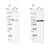 Anti-RPAP3 antibody produced in rabbit Prestige Antibodies® Powered by Atlas Antibodies, affinity isolated antibody, buffered aqueous glycerol solution