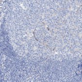 Anti-MAGI1 antibody produced in rabbit Prestige Antibodies® Powered by Atlas Antibodies, affinity isolated antibody, buffered aqueous glycerol solution, ab2