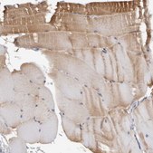 Anti-PGM1 antibody produced in rabbit Prestige Antibodies® Powered by Atlas Antibodies, affinity isolated antibody, buffered aqueous glycerol solution, Ab1