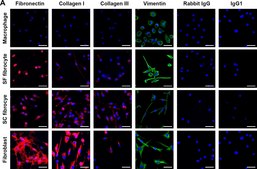 抗-纤连蛋白 兔抗 affinity isolated antibody, buffered aqueous solution
