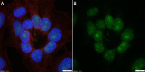 Anti-Phospho-IκBα-Ser32/36 Antibody, clone 1I11 ZooMAb® Rabbit Monoclonal recombinant, expressed in HEK 293 cells