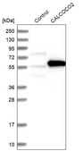Anti-CALCOCO2 antibody produced in rabbit Prestige Antibodies® Powered by Atlas Antibodies, affinity isolated antibody, buffered aqueous glycerol solution, Ab2