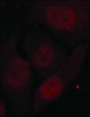 Anti-phospho-HDAC2 (pSer394) antibody produced in rabbit affinity isolated antibody