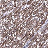 Anti-CRYAB antibody produced in rabbit Prestige Antibodies® Powered by Atlas Antibodies, affinity isolated antibody, buffered aqueous glycerol solution