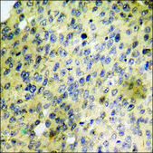 Anti-phospho-SGK (pSer422) antibody produced in rabbit affinity isolated antibody
