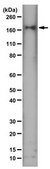 Anti-PDGFR Beta Antibody from rabbit, purified by affinity chromatography