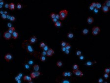 Duolink® In Situ Detection Reagents Red
