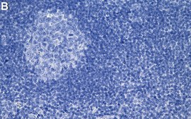 Anti-IL-18 Antibody, clone 1N23 ZooMAb® Rabbit Monoclonal recombinant, expressed in HEK 293 cells