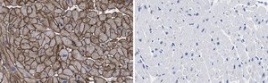 Anti-Laminin B2 Antibody, clone 1B9 ZooMAb® Rabbit Monoclonal recombinant, expressed in HEK 293 cells