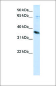 Anti-ST6GALNAC1 antibody produced in rabbit affinity isolated antibody
