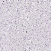 Anti-PI3 antibody produced in rabbit Prestige Antibodies® Powered by Atlas Antibodies, affinity isolated antibody, buffered aqueous glycerol solution