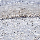 抗-COL1A1 兔抗 Prestige Antibodies® Powered by Atlas Antibodies, affinity isolated antibody, buffered aqueous glycerol solution