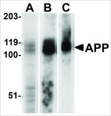 Anti-APP antibody produced in rabbit affinity isolated antibody, buffered aqueous solution