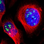 Anti-ZSCAN1 antibody produced in rabbit Prestige Antibodies® Powered by Atlas Antibodies, affinity isolated antibody, buffered aqueous glycerol solution