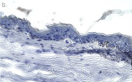 Anti-Collagen Type VII Antibody, clone 1E5 ZooMAb® Rabbit Monoclonal recombinant, expressed in HEK 293 cells