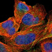 抗-ABCC1 兔抗 Prestige Antibodies® Powered by Atlas Antibodies, affinity isolated antibody, buffered aqueous glycerol solution, Ab1