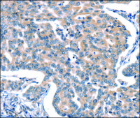 Anti-CACNA1A antibody produced in rabbit affinity isolated antibody