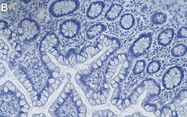 Anti-PTBP1/PTB Antibody, clone 1G23 ZooMAb® Rabbit Monoclonal recombinant, expressed in HEK 293 cells