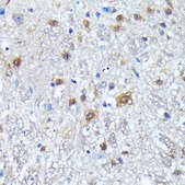 Anti- LC3B antibody produced in rabbit