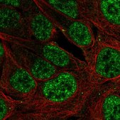 Anti-PLAG1 antibody produced in rabbit Prestige Antibodies® Powered by Atlas Antibodies, affinity isolated antibody