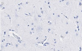 Anti-Neurofilament M Antibody, clone 1B23 ZooMAb® Rabbit Monoclonal recombinant, expressed in HEK 293 cells