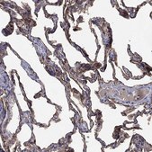 Anti-AGER antibody produced in rabbit Prestige Antibodies® Powered by Atlas Antibodies, affinity isolated antibody, buffered aqueous glycerol solution