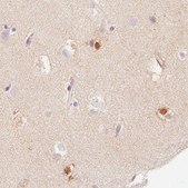 Monoclonal Anti-FABP7 antibody produced in mouse Prestige Antibodies® Powered by Atlas Antibodies, clone CL0236, purified immunoglobulin, buffered aqueous glycerol solution