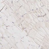 Anti-CTNNB1 antibody produced in rabbit Prestige Antibodies® Powered by Atlas Antibodies, affinity isolated antibody, buffered aqueous glycerol solution, ab2