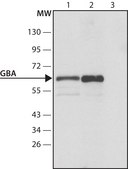 Anti-Glucocerebrosidase 兔抗 ~1 mg/mL, affinity isolated antibody, buffered aqueous solution