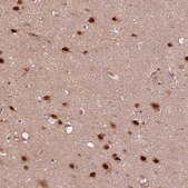 Anti-PSMC5 antibody produced in rabbit Prestige Antibodies® Powered by Atlas Antibodies, affinity isolated antibody