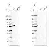 Anti-FTCD antibody produced in rabbit Prestige Antibodies® Powered by Atlas Antibodies, affinity isolated antibody, buffered aqueous glycerol solution
