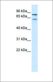 Anti-KCNQ1 affinity isolated antibody