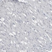 Anti-ACSF2 antibody produced in rabbit Prestige Antibodies® Powered by Atlas Antibodies, affinity isolated antibody, buffered aqueous glycerol solution