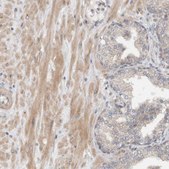 Anti-MPRIP antibody produced in rabbit Prestige Antibodies® Powered by Atlas Antibodies, affinity isolated antibody, buffered aqueous glycerol solution, Ab1