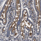 Anti-NT5E antibody produced in rabbit Prestige Antibodies® Powered by Atlas Antibodies, affinity isolated antibody, buffered aqueous glycerol solution