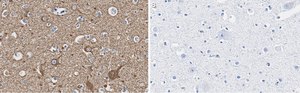Anti-Neurofilament L Antibody, clone 1E13 ZooMAb® Rabbit Monoclonal recombinant, expressed in HEK 293 cells