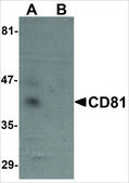 抗CD81 兔抗 affinity isolated antibody, buffered aqueous solution
